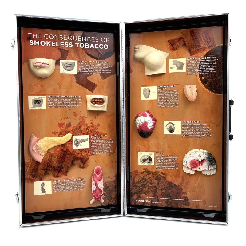 Smokeless Tobacco Consequences 3-D Display